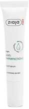 Näoseerum Ziaja Med Anti-Imperfections Spot Serum, 15 ml