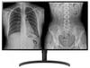 LG 32HL512D
